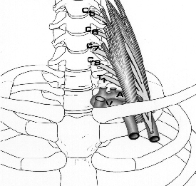 the thoracic outlet syndrome